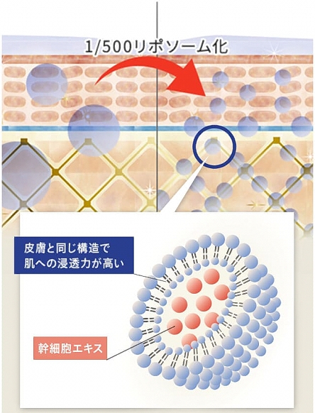 ���|�\�[����