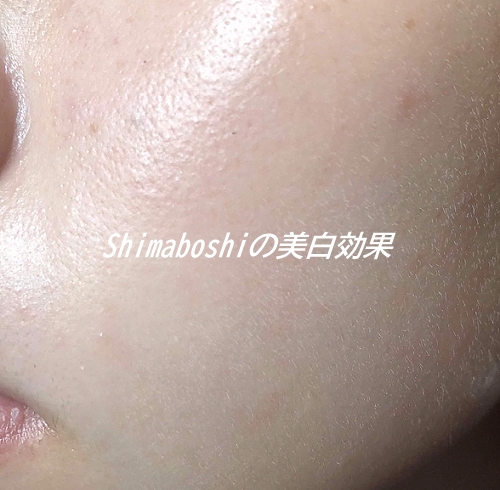 �V�}�{�V�̔���