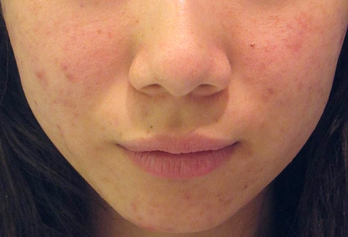 �j�L�r�̉摜